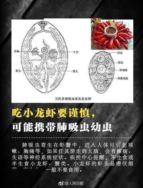 寄生蟲|平時愛吃這些東西！17歲少女腸道內布滿寄生蟲，醫生都嚇一跳