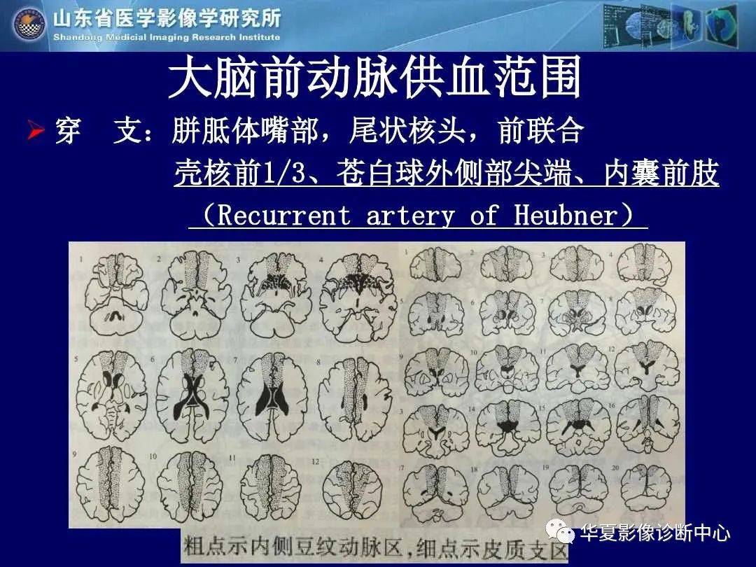 诊断|缺血性脑血管病的影像诊断