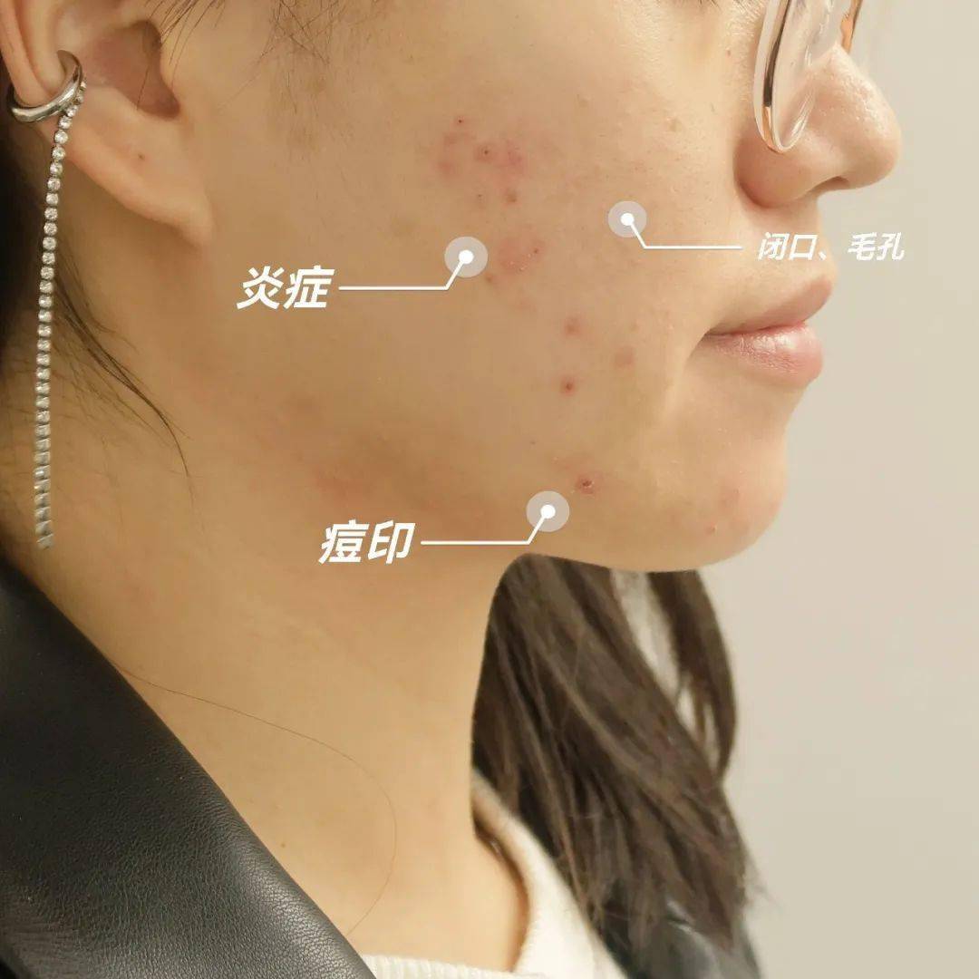 模式都是整，还是她的整法高级
