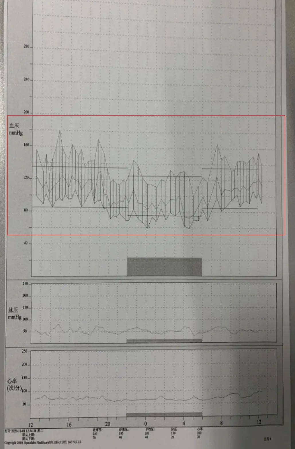 动态血压报告不会看12个要点帮你梳理好啦