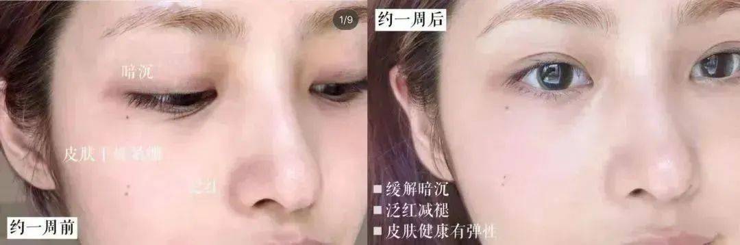 代小雅诗兰黛七代小棕瓶，双11捡漏价入！