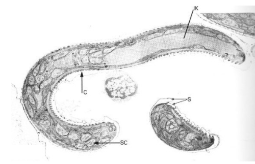 你肚子里有虫 寄生虫