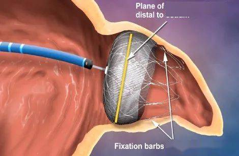 心律|【金沙讲坛】危险的“心动”——房颤