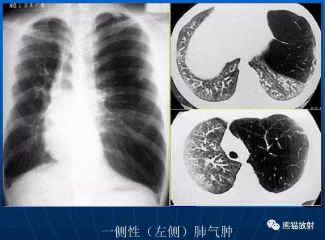 「x線診斷要點」關於