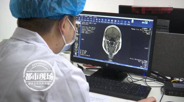 耳屎|她老爱掏耳朵，竟掏出恶性肿瘤？！