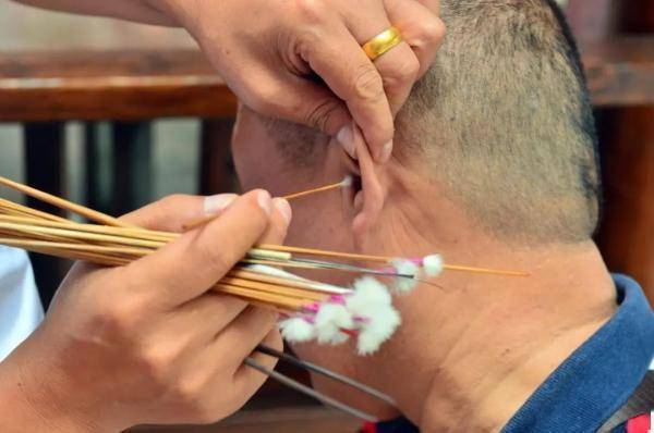 男子|杭州男子耳朵里长满“苔藓”，医生一看惊了！他的习惯很多人都有！