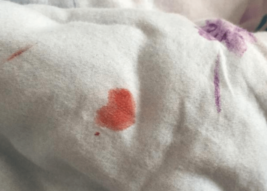 女人上厕所有3个"异常",宫颈已奄奄一息,一个不占,子宫还健康