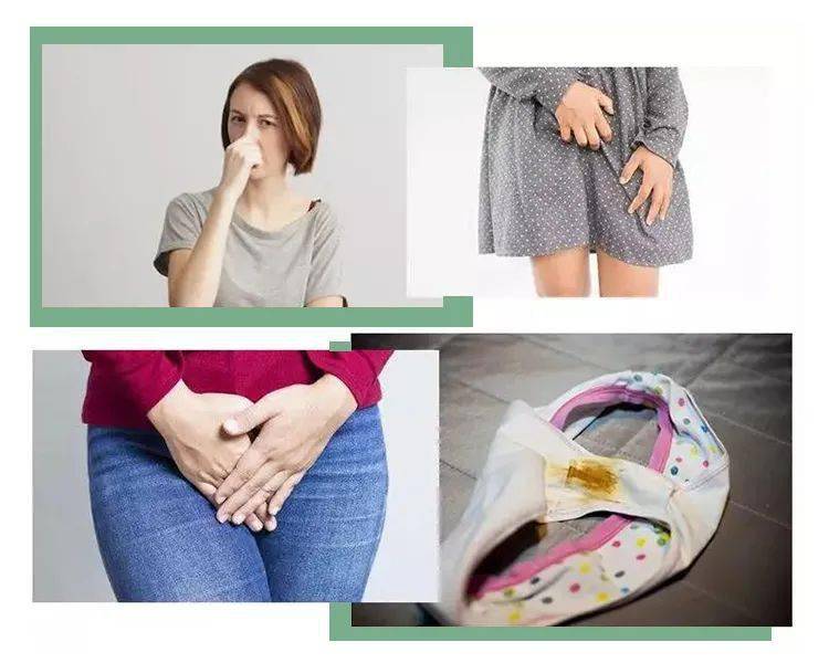 下面又臭又痒内裤还发黄发硬这些性知识你真的了解吗