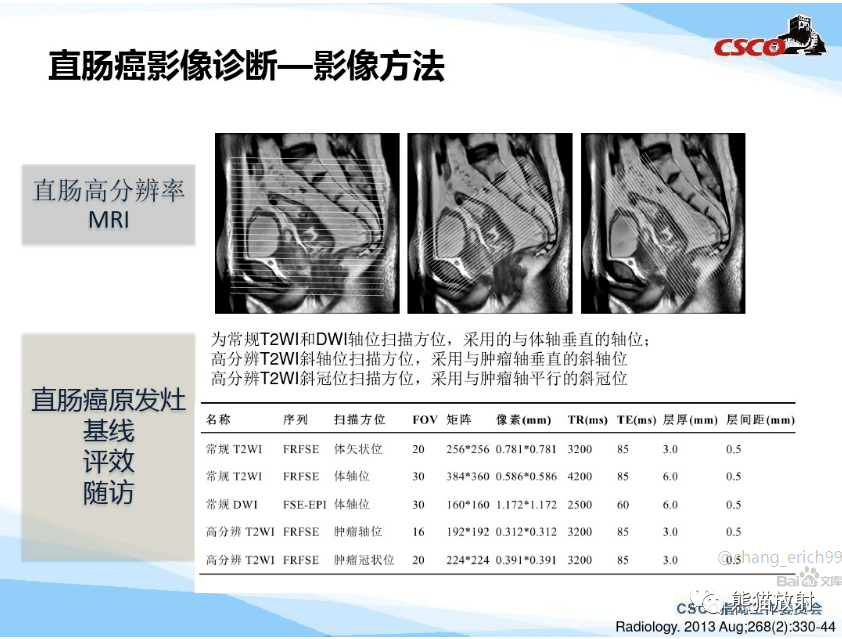 直腸癌丨mri解剖掃描規範影像學評價結構式報告