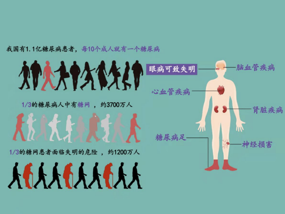 剂型|警惕！我国每10人中就有1位糖尿病患者！这些细节很重要→