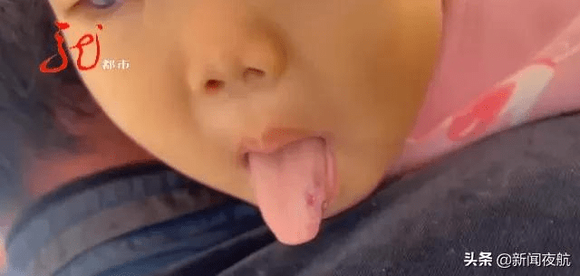 白云瑞|哈尔滨一岁女童浑身淤青、口腔淤血……她不幸被确诊，父母崩溃了