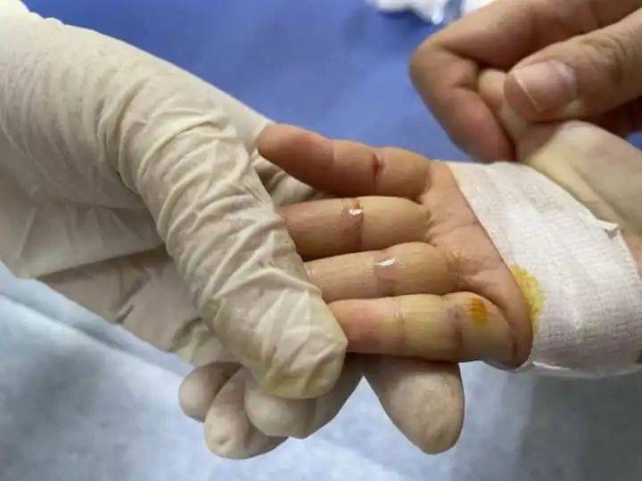 女童|2岁女童反复患肺炎，爸爸说出一个“秘密”，妈妈绷不住了