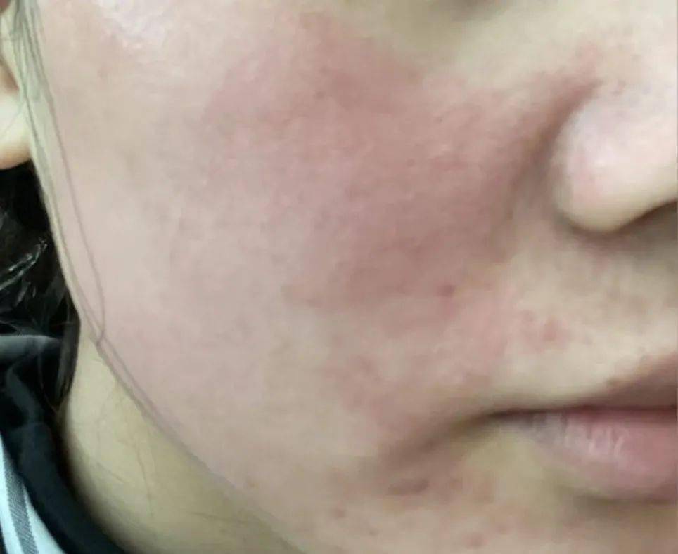 脸部女人的衣服,永远不嫌多