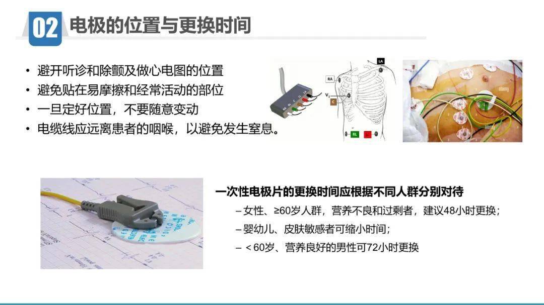 心電監護儀的應用與護理