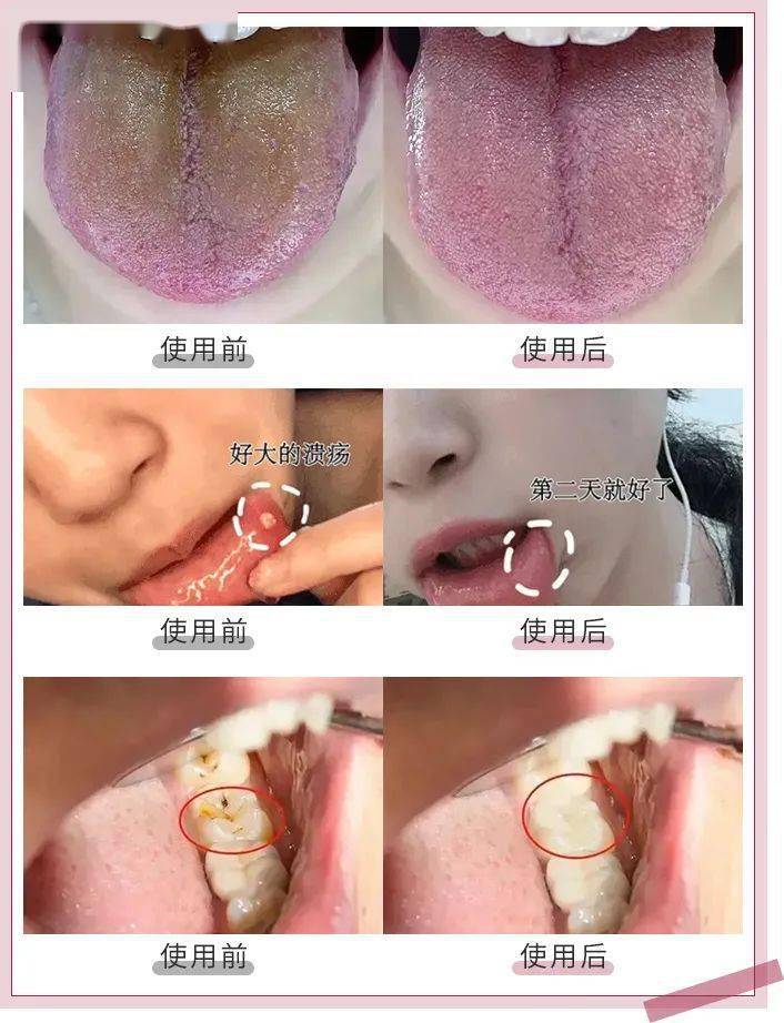 效果|又到火锅季，担心上火？降火神器了解一下