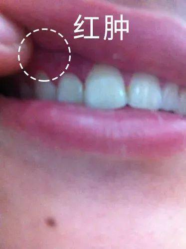 效果|又到火锅季，担心上火？降火神器了解一下