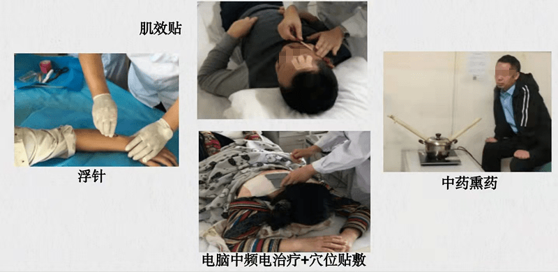 技术|【义诊通知】医院11月22日举办“世界针灸日”义诊活动