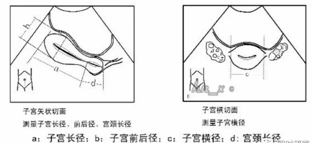 圖2-1-10 子宮肌層血流分佈三維成像