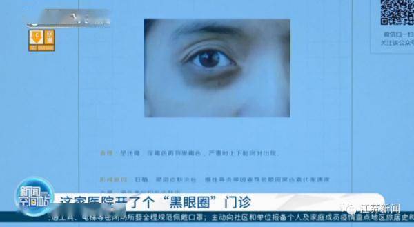 胡亮|南京一医院开设黑眼圈门诊！网友沸腾了：马上去挂号！