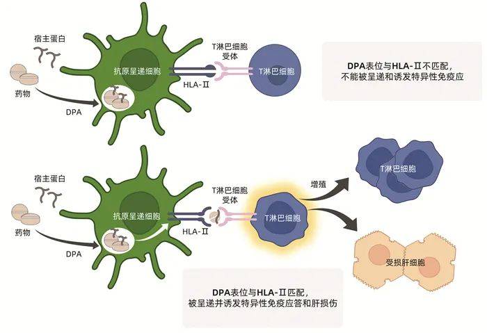 專家論壇|於樂成,陳成偉:藥物性肝損傷的發生機制——當前認識和未來