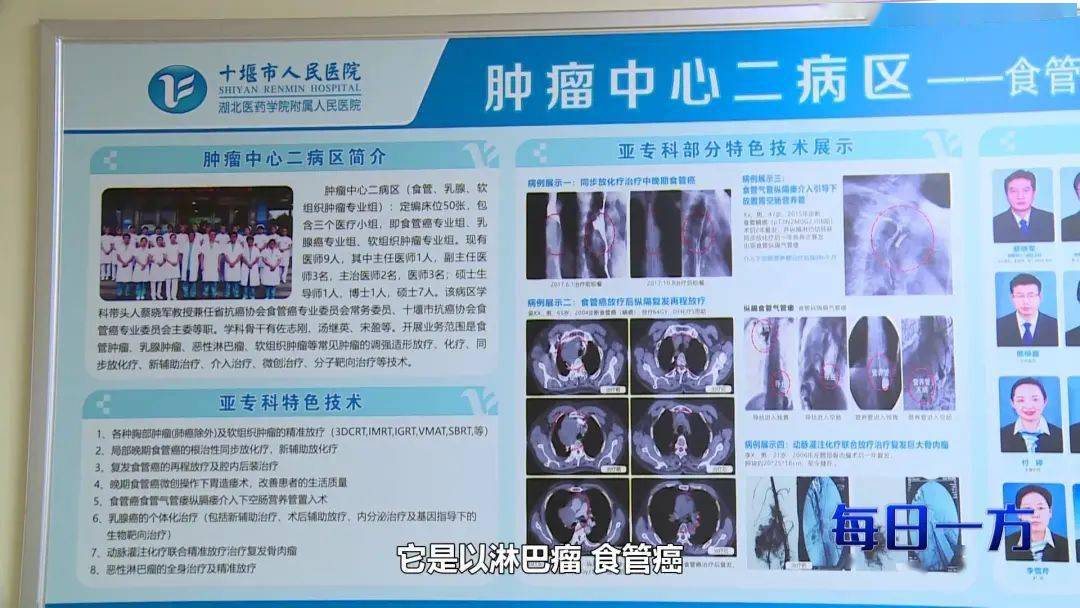 以为是胃痛结果却查出若有这些症状千万耽误不得