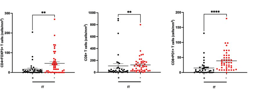Treg|免疫治疗前用TACE铺路，或是肝癌治疗的全新妙招！