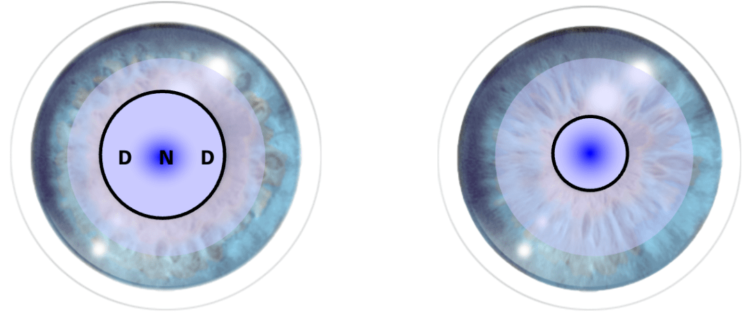 解决老花和视疲劳的新策略博士伦多焦点软镜的设计原理及验配要点