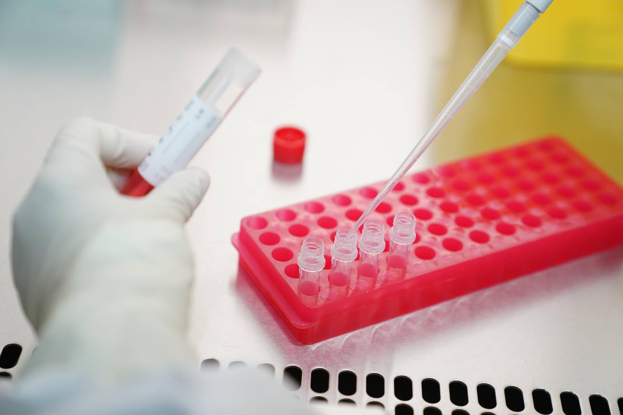 黄品超|杭州第二轮核酸检测累计采样52765人次，均为阴性