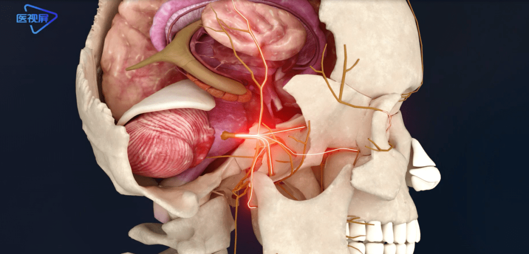 醫學3d天下第一痛三叉神經的解剖結構
