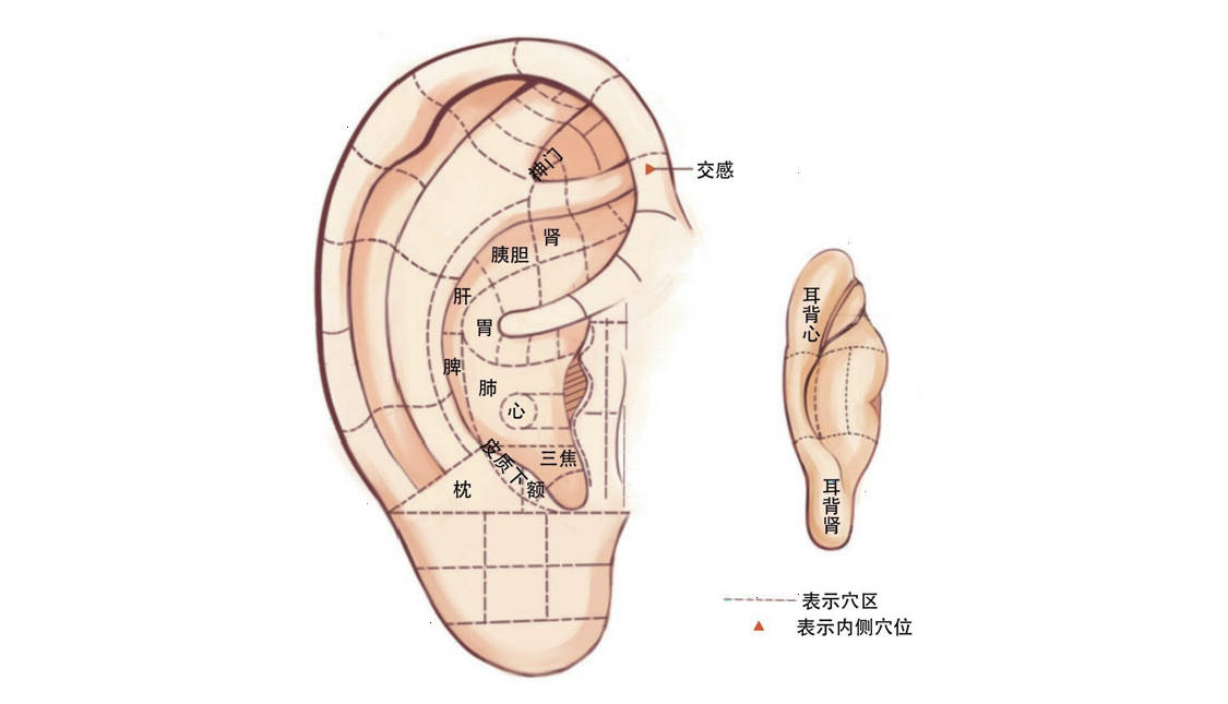 耳豆失眠位置图图片