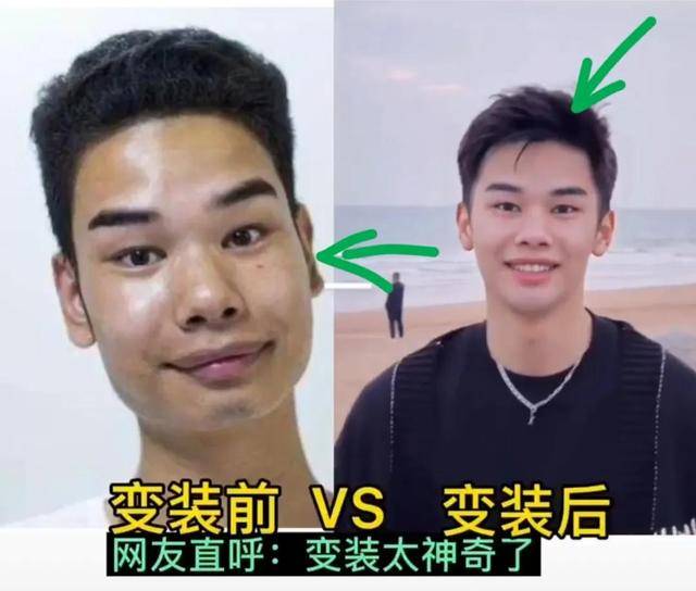 你还认得出这张脸吗?发际线网红小吴变成帅哥,还得到富婆青睐