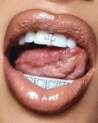 要说最出乎意料的天然钻石珠宝,不得不提金·卡戴珊的镶钻牙饰.