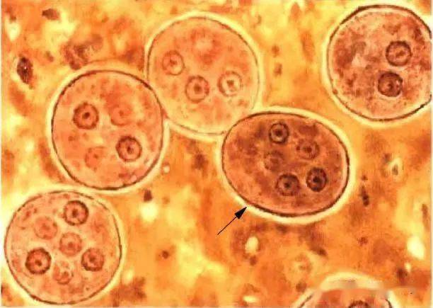 卵的名稱大小約為(130-150)x(63-90)um)點擊空白處查看答案布氏薑片吸