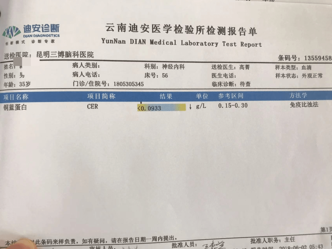 病例35歲男性雙手不自主抖動10年肝豆狀核變性繼發震顫