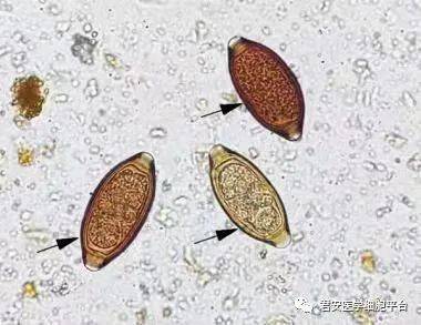 所指寄生蟲的名稱2021404微小膜殼絛蟲(蟲卵)點擊空白處查看答案大小