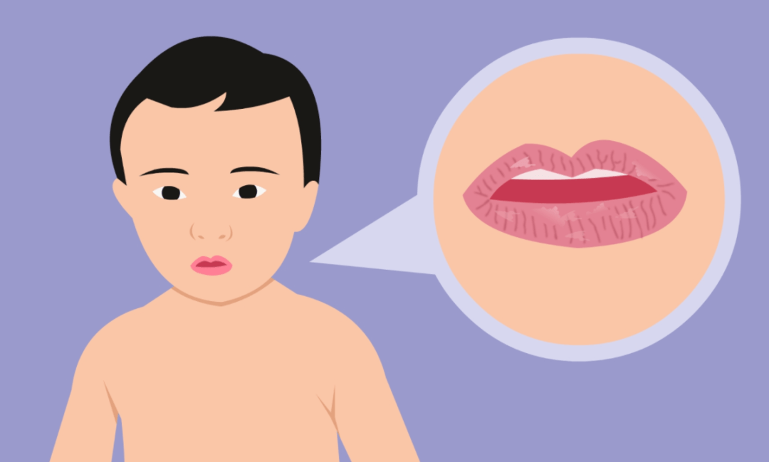 冷空气来临,这个地方干干干.建议这样做_嘴唇_成分_唾液