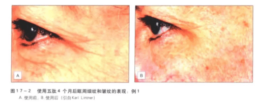 凯特36岁艳绝皇室？英国王妃凯特近照美翻！网友看到键盘都敲烂了