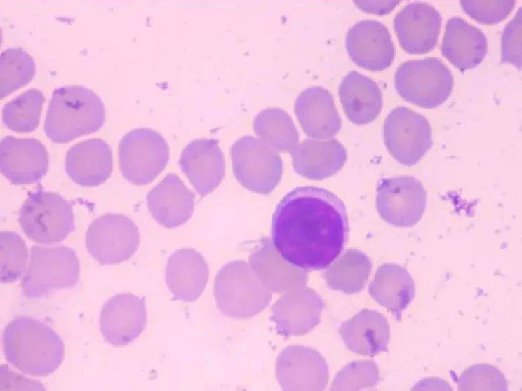 肠道|阑尾，是废物吗？