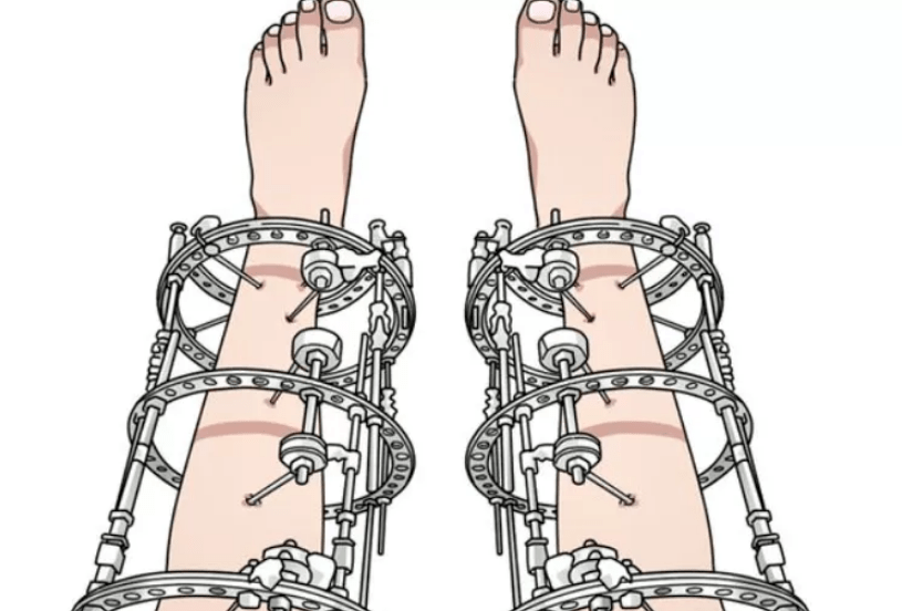 中国|国人的身高焦虑，又卷到了谁