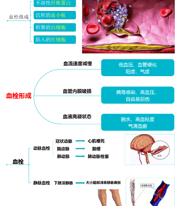 医学上对于血栓有抗血小板聚集或者凝血因子的药物,还有溶栓药等等