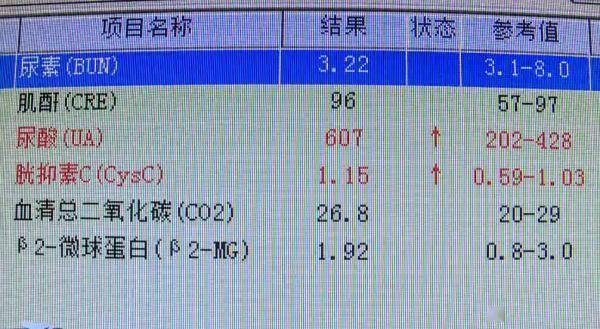 广东|每天喝十几瓶啤酒，广东一男子体内抽出“牛奶”