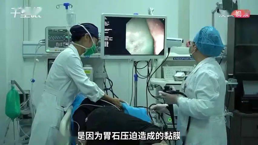 男子|阿姨空腹吃山楂长结石，喝10桶可乐康复：我感觉治病过程还挺快乐的 | 冷兔小报 No.665