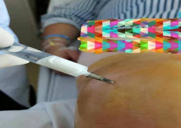 广东|每天喝十几瓶啤酒，广东一男子体内抽出“牛奶”