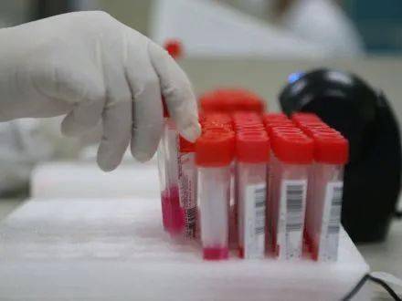 实时|如何看懂你的新冠核酸检测报告