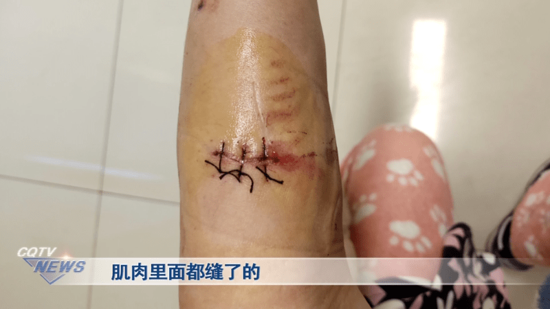 小区里能不能饲养伤过人的宠物狗狗主人和伤者争执不休