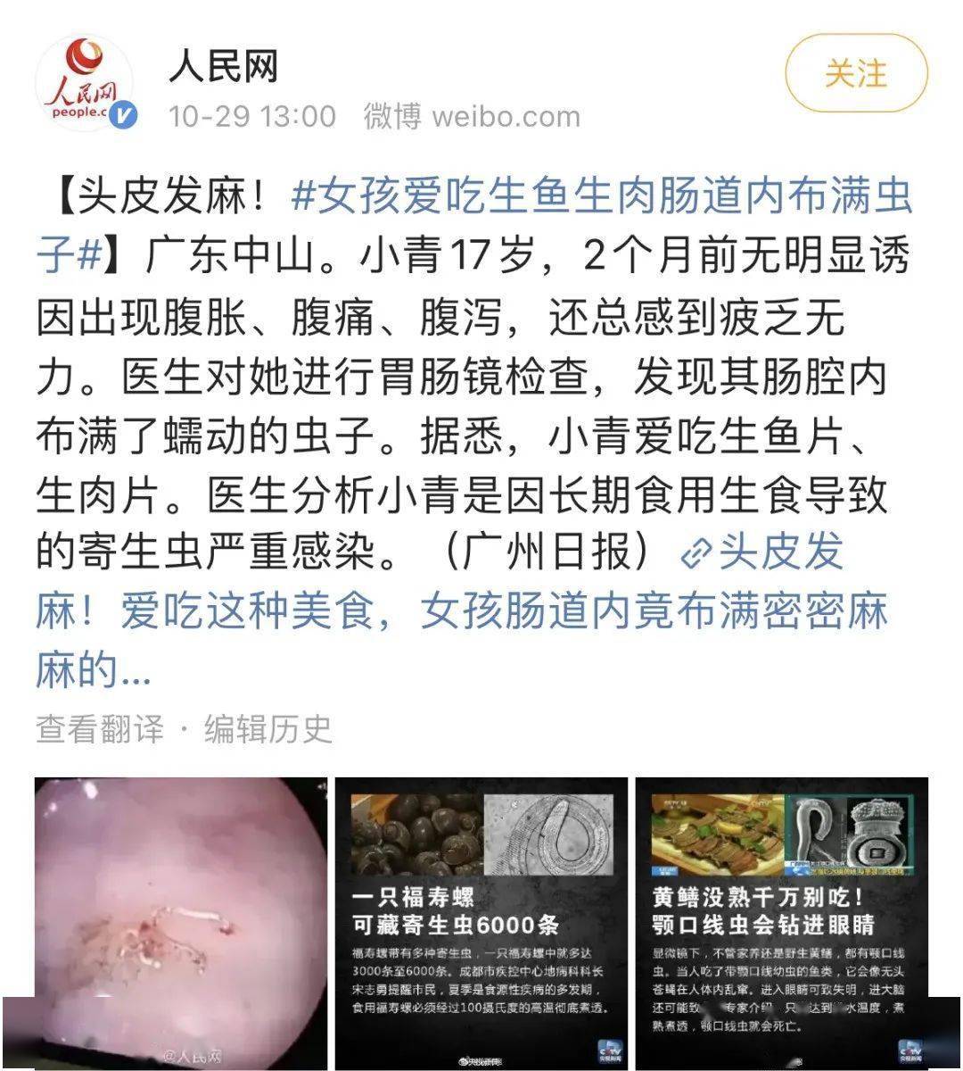 防止你没看清第一张图我给你单独放出来了还有的华支睾吸虫住进了胆囊