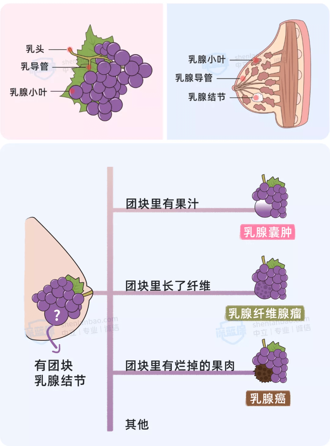 乳腺结节是怎么回事图片