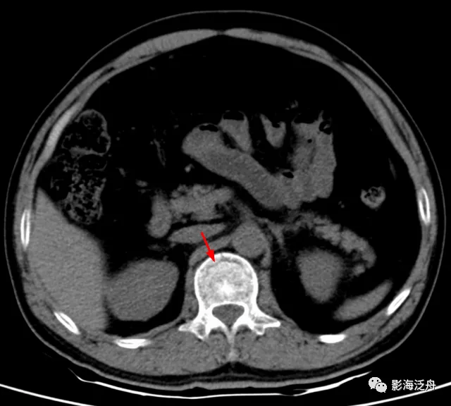静脉|影像阅片，千万不能“掐头去尾”
