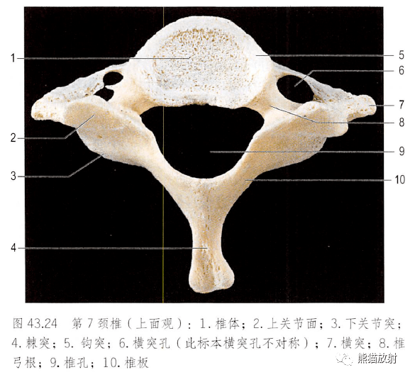 解剖丨脊柱椎體椎間盤韌帶