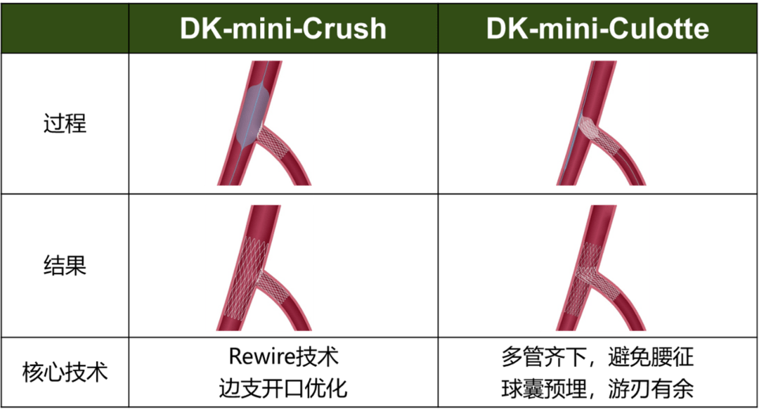 流程crush流程图culotte流程图从它们的具体过程来看,共分为10个步骤